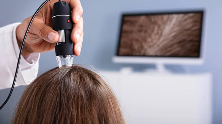 Hair Analysis (Scanning)